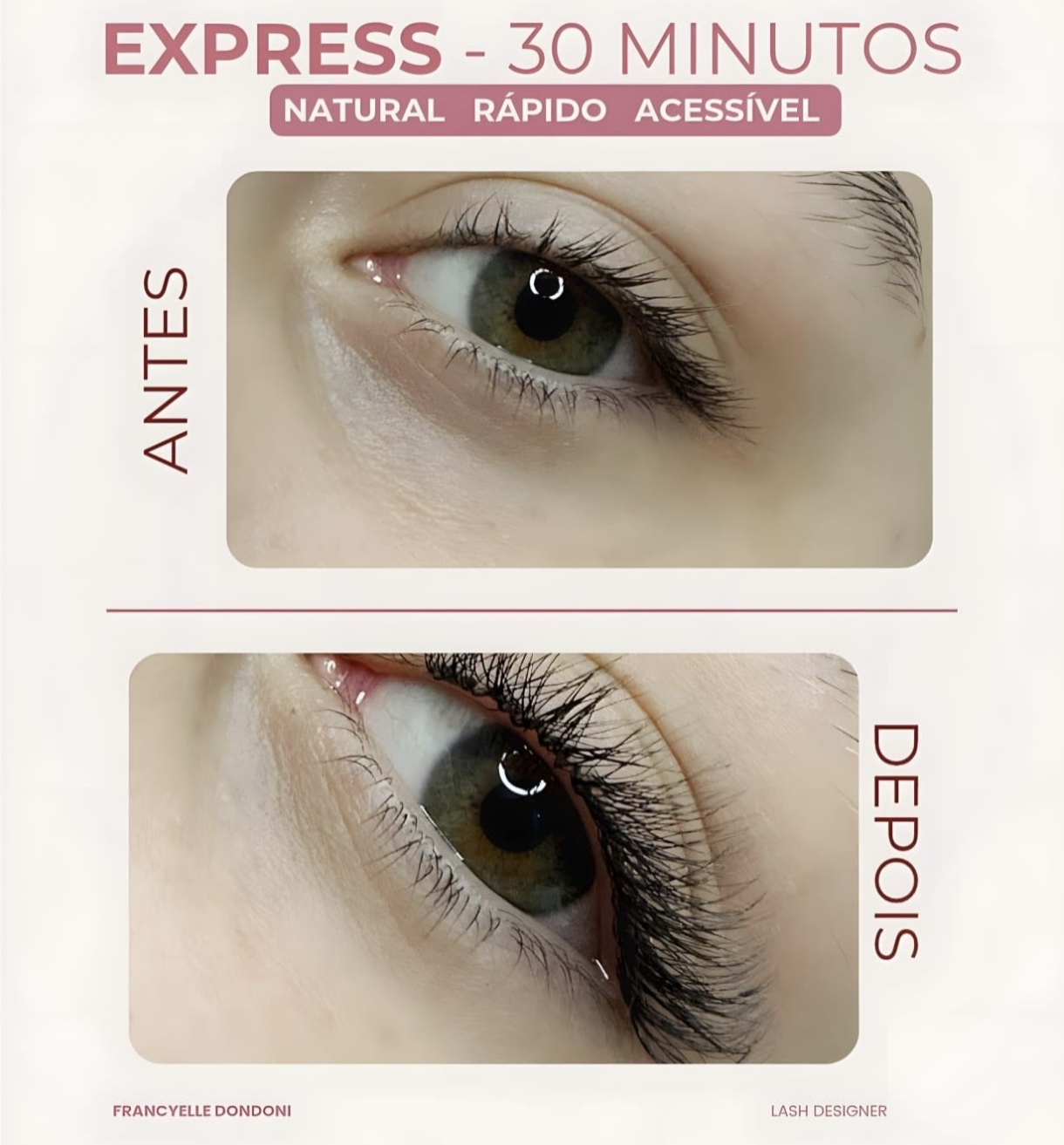 Antes e depois da técnica Express